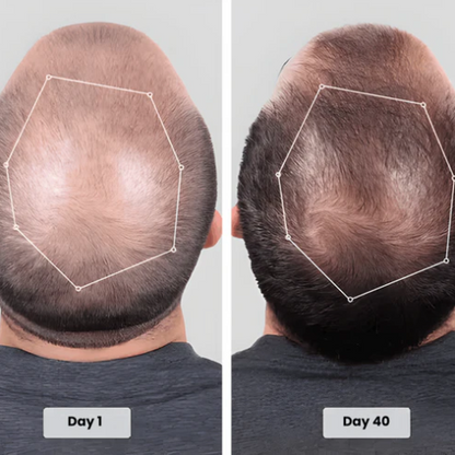 Red Light Therapy Cap for Hair Regrowth Treatment